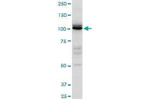 IDE polyclonal antibody (A01), Lot # ABNOVA060711QCS1. (IDE antibody  (AA 920-1019))