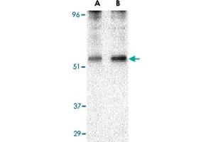 Western blot analysis of PLIN3 in EL4 cell lysate with PLIN3 polyclonal antibody  at (A) 0.