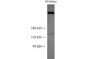 Western Blot analysis of Mouse kidney using Sptan1 Polyclonal Antibody at dilution of 1:1000 (SPTAN1 antibody)