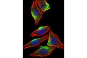 Immunofluorescence (IF) image for anti-Calcium/calmodulin-Dependent Protein Kinase IV (CAMK4) (AA 35-292) antibody (ABIN1098144)