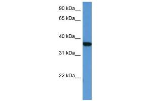 WB Suggested Anti-MAPKAPK2 Antibody Titration: 0. (MAPKAP Kinase 2 antibody  (Middle Region))