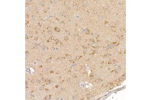 Immunohistochemistry of paraffin-embedded mouse brain using RC Rabbit pAb (ABIN6129452, ABIN6146811, ABIN6146812 and ABIN6220955) at dilution of 1:150 (40x lens).