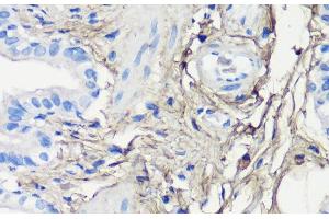 Immunohistochemistry of paraffin-embedded Rat lung using Decorin Polyclonal Antibody at dilution of 1:200 (40x lens). (Decorin antibody)