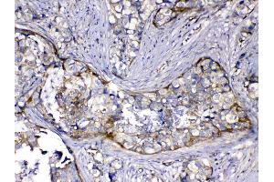 IHC analysis of HOMER3 using anti-HOMER3 antibody . (HOMER3 antibody  (AA 282-360))