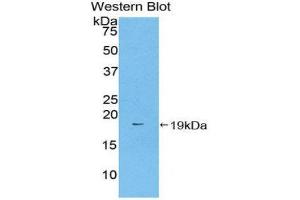 Western Blotting (WB) image for anti-Coagulation Factor II (thrombin) (F2) (AA 201-324) antibody (ABIN1859317) (Prothrombin antibody  (AA 201-324))