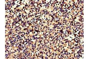 Immunohistochemistry of paraffin-embedded human spleen tissue using ABIN7146648 at dilution of 1:100 (CNR2 antibody  (AA 305-360))