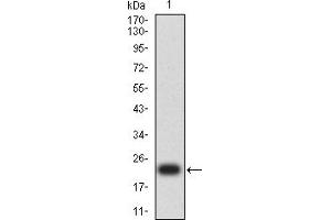 Western blot analysis using MYLK mAb against human MYLK (AA:1375-1524) recombinant protein. (MYLK antibody  (AA 1375-1524))