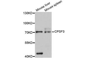 Western blot analysis of extracts of various cell lines, using CPSF3 antibody (ABIN5997506) at 1:3000 dilution. (CPSF3 antibody)