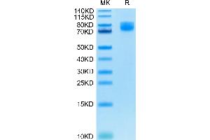 Human CD86 on Tris-Bis PAGE under reduced condition. (CD86 Protein (CD86) (AA 26-247) (Fc Tag))