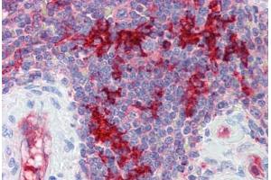 Human Spleen (formalin-fixed, paraffin-embedded) stained with RAE1 antibody ABIN462225 followed by biotinylated goat anti-rabbit IgG secondary antibody ABIN481713, alkaline phosphatase-streptavidin and chromogen. (RAE1 antibody  (C-Term))