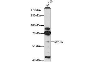 Western blot analysis of extracts of A-549 cells, using SPRTN antibody (ABIN4905287) at 1:3000 dilution. (Spartan antibody)
