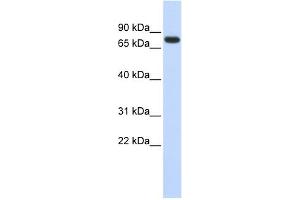 WB Suggested Anti-ANKRD13B Antibody Titration: 0. (ANKRD13B antibody  (Middle Region))