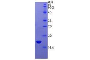 Image no. 1 for Sema Domain, Immunoglobulin Domain (Ig), Short Basic Domain, Secreted, (Semaphorin) 3A (SEMA3A) (AA 31-141) (Active) protein (His tag) (ABIN6239918) (SEMA3A Protein (AA 31-141) (His tag))