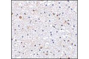 Immunohistochemistry of PD-1 in Human brain tissue with AP30650PU-N PD1 antibody at 2. (PD-1 antibody  (C-Term))