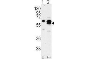 Western blot analysis of CAMK1G (arrow) using rabbit polyclonal CAMK1G Antibody (C-term) . (CAMK1G antibody  (C-Term))
