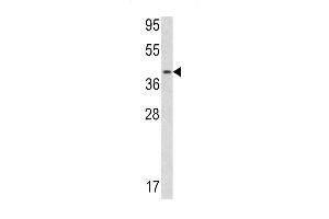 Western blot analysis of Calponin-3 antibody (Center) (ABIN390504 and ABIN2840860) in NIH-3T3 cell line lysates (35 μg/lane). (CNN3 antibody  (AA 129-158))