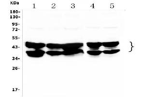 Western blot analysis of HNRNPD using anti-HNRNPD antibody (ABIN7602590).