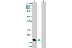 Western Blot analysis of MCEE expression in transfected 293T cell line by MCEE MaxPab polyclonal antibody. (MCEE antibody  (AA 1-176))