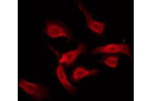 ABIN6275966 staining HT29 by IF/ICC. (GPR18 antibody  (Internal Region))
