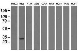 Image no. 2 for anti-Glutathione S-Transferase theta 2 (GSTT2) antibody (ABIN1498558)