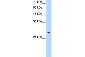 WB Suggested Anti-ADH6 Antibody Titration:  1. (ADH6 antibody  (Middle Region))