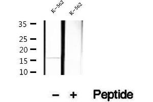 Western blot analysis of extracts of K-562 cells, using Hemoglobin epsilon antibody.