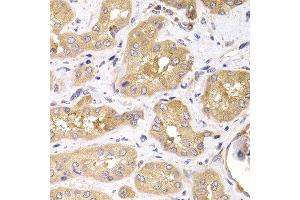 Immunohistochemistry of paraffin-embedded human kidney using RPS4X antibody at dilution of 1:100 (x400 lens). (RPS4X antibody)