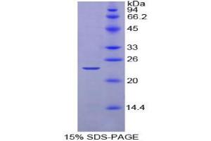 SDS-PAGE analysis of Chicken Noggin Protein. (NOG Protein)
