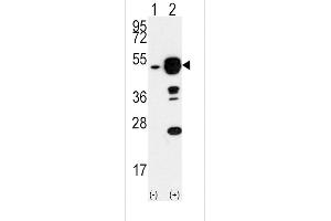Western blot analysis of EIF4A1 (arrow) using rabbit polyclonal EIF4A1 Antibody (N-term) (ABIN391393 and ABIN2841397).