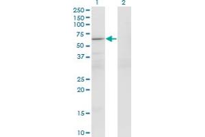 Western Blot analysis of PATZ1 expression in transfected 293T cell line by PATZ1 monoclonal antibody (M01), clone 1B2.