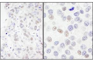 anti-NLR Family, Pyrin Domain Containing 2 (NLRP2) (AA 425-475) antibody