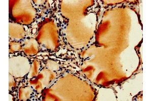 IHC image of ABIN7142736 diluted at 1:250 and staining in paraffin-embedded human thyroid tissue performed on a Leica BondTM system. (RPL11 antibody  (AA 3-178))