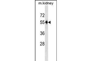 Mouse Pnpla3 Antibody (C-term) (ABIN1537205 and ABIN2850147) western blot analysis in mouse kidney tissue lysates (35 μg/lane). (PNPLA3 antibody  (C-Term))