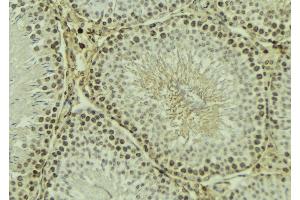 ABIN6269091 at 1/100 staining Mouse testis tissue by IHC-P. (Integrin beta 3 antibody  (C-Term))