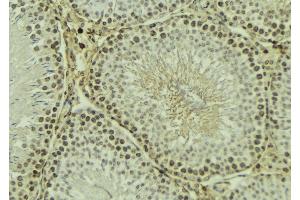 ABIN6269091 at 1/100 staining Mouse testis tissue by IHC-P.