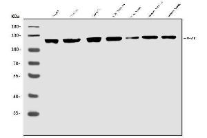 Western blot analysis of MERTK using anti-MERTK antibody (ABIN7600623).