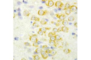 Anti-FGF9 antibody, IHC(P): Rat Brain Tissue (FGF9 antibody  (Middle Region))