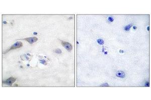Immunohistochemistry (IHC) image for anti-Protein Phosphatase 1, Regulatory (Inhibitor) Subunit 1B (PPP1R1B) (Thr75) antibody (ABIN1847886)