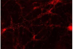 Indirect immunofluorescence labeling of PFA fixed rat hippocampus neurons (dilution 1 : 500). (Uncoating ATPase (AA 1-650) antibody)
