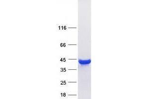 Western Blotting (WB) image for Aldolase A, Fructose-Bisphosphate (ALDOA) (Transcript Variant 3) protein (Myc-DYKDDDDK Tag) (ABIN2714556)