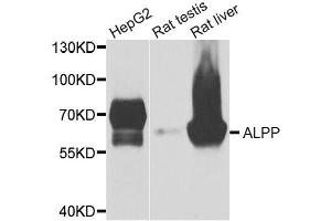 Western blot analysis of extracts of various cell lines, using ALPP antibody. (PLAP antibody)