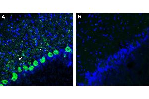 Immunohistochemical staining of perfusion-fixed frozen rat brain sections using Anti-SLC36A1 (PAT1) Antibody (ABIN7885483), (1:300), followed by goat anti-rabbit-.