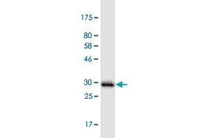Western Blot detection against Immunogen (31. (PIGW antibody  (AA 399-447))