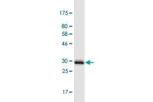 Western Blot detection against Immunogen (31. (PIGW antibody  (AA 399-447))