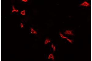 Immunofluorescence (fixed cells) (IF/ICC) image for anti-Sodium Channel, Nonvoltage-Gated 1, gamma (SCNN1G) (C-Term) antibody (ABIN6261528)