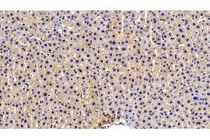 Immunohistochemistry (IHC) image for anti-Hypoxia Inducible Factor 1, alpha Subunit (Basic Helix-Loop-Helix Transcription Factor) (HIF1A) (AA 216-336) antibody (ABIN7432643)