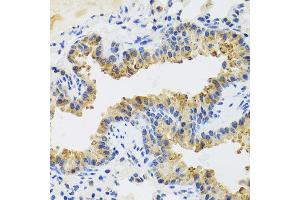 Immunohistochemistry of paraffin-embedded mouse lung using UVRAG antibody at dilution of 1:100 (x40 lens).