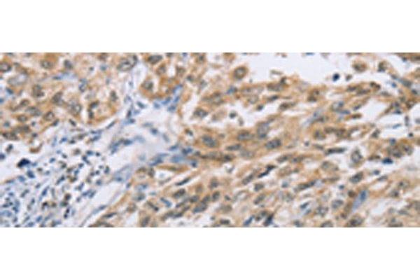 ZIC5 antibody