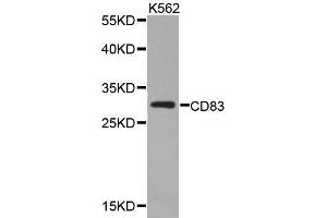 Western blot analysis of extracts of K562 cell lines, using CD83 antibody. (CD83 antibody  (AA 20-144))