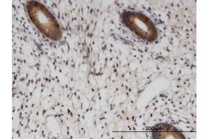 Immunoperoxidase of monoclonal antibody to RAB1B on formalin-fixed paraffin-embedded human endometrium. (RAB1B antibody  (AA 91-201))